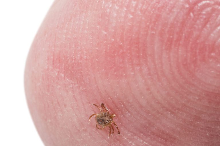 Tick Bites Are Sending More People to ERs Than Ever
